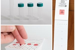 Cortisol Testing in Saliva, Blood & Urine