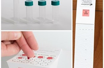 Cortisol Testing in Saliva, Blood & Urine
